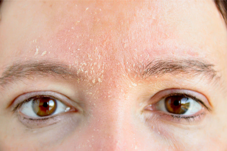 DRY & DELICATE SKIN