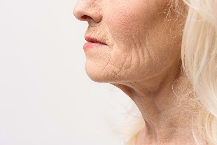 SIGNS OF SKIN AGING